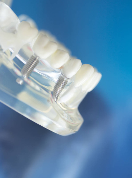 Модель рота зубів зубів
 - Фото, зображення