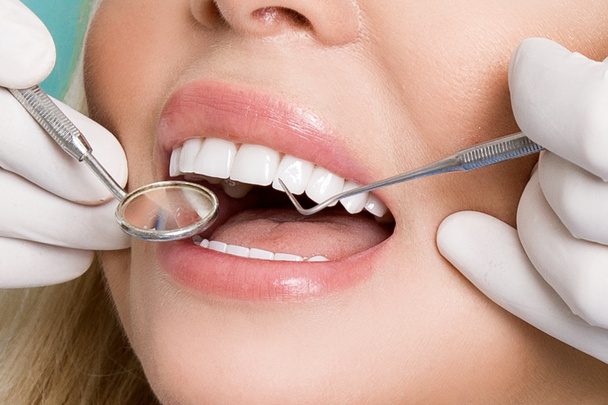 Mulher bonita nova com dentes brancos bonitos sentados em uma cadeira dental. O dentista cura os dentes.
. - Foto, Imagem