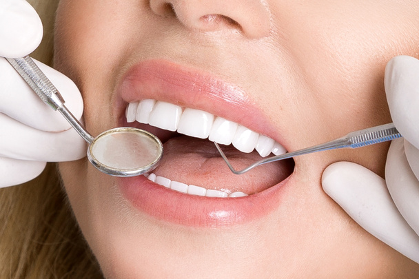 Νεαρή όμορφη γυναίκα με όμορφα λευκά δόντια που κάθεται σε μια πολυθρόνα. Ο οδοντίατρος θεραπεύει τα δόντια της. - Φωτογραφία, εικόνα