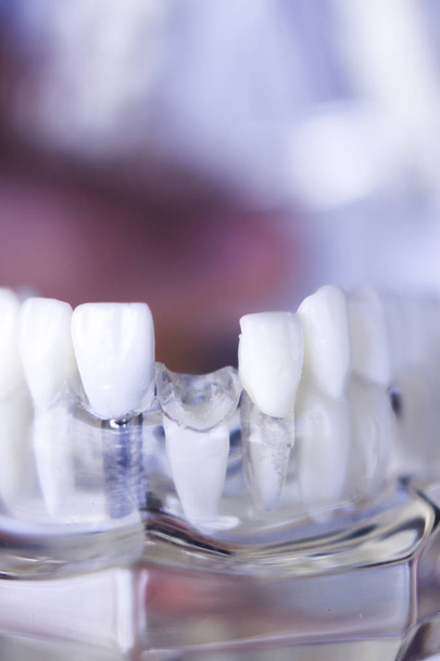 Οδοντιατρική δόντια μοντέλο Dentsts - Φωτογραφία, εικόνα