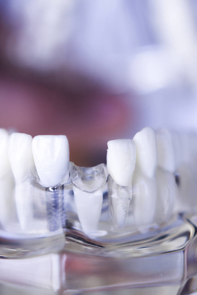 Dentstas modelo de dentes dentários
 - Foto, Imagem