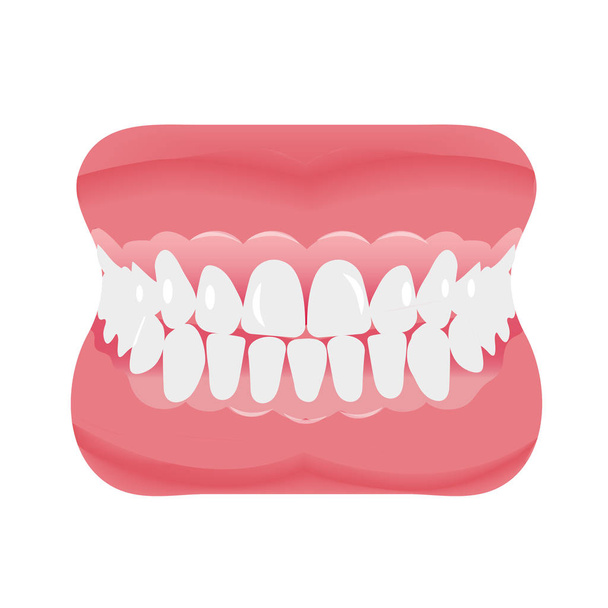 Leuka hampaat kuvake tasainen tyyli. Suu auki, tekohampaat. Hammaslääketiede, lääketiede. Eristetty valkoisella taustalla. Vektoriesimerkki. - Vektori, kuva