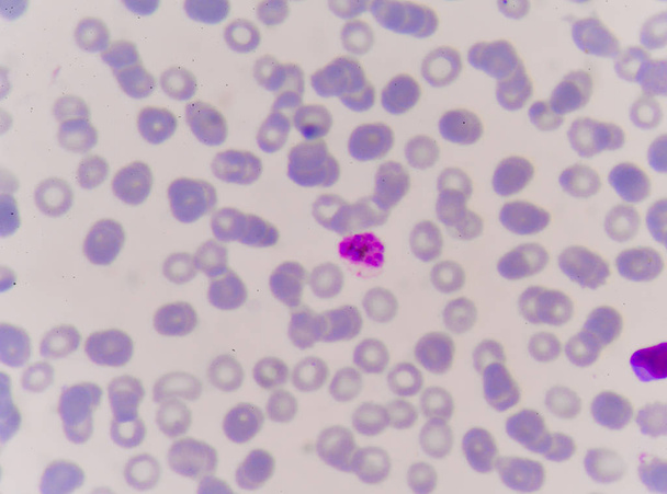 Chiudi il pigmento della malaria dei globuli rossi
. - Foto, immagini