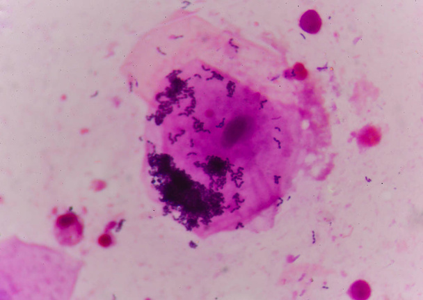 célula bacteriana en método de tinción de gramo
. - Foto, Imagen