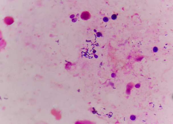 bacteriën cel in gram vlek methode. - Foto, afbeelding