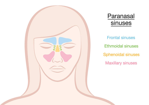 Paranasal Sinuses Woman - Vector, Image