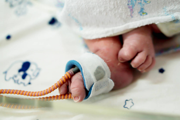 krankes neugeborenes Baby Fuß  - Foto, Bild