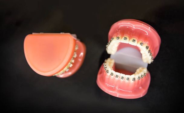 зубні імплантати в клініці
 - Фото, зображення