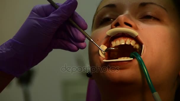 Attaching the braces to the tooth, accelerated video - Footage, Video