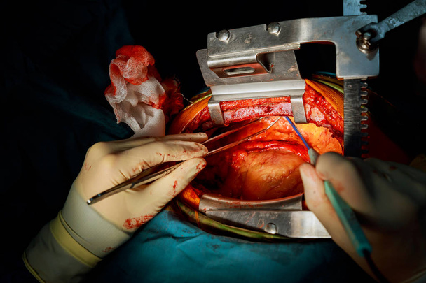 外科手術室で外科医は心を開いて手順を手します。 - 写真・画像