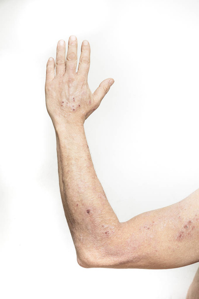 Homme ayant des démangeaisons et un problème de peau sèche
 - Photo, image