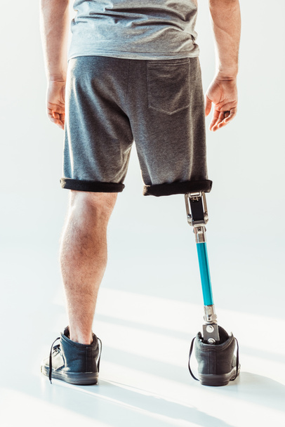 man met beenprothese - Foto, afbeelding