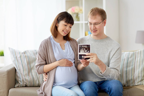 happy couple with ultrasound images at home - Фото, изображение