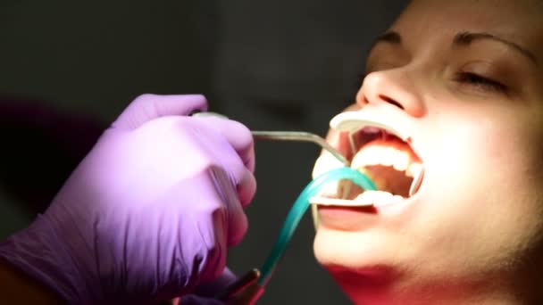 dentista está poniendo frenos en los dientes de una mujer joven
 - Metraje, vídeo
