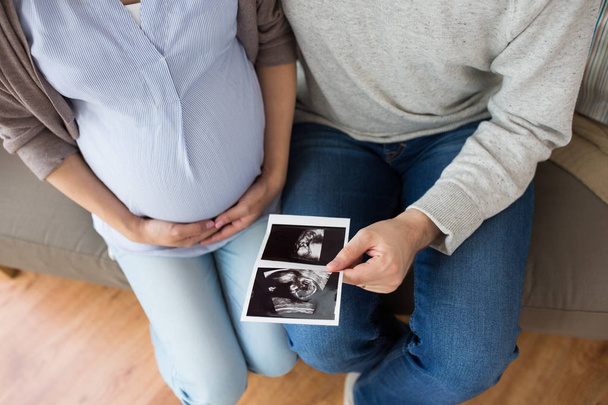 lähikuva pari vauvan ultraääni kuvia
 - Valokuva, kuva