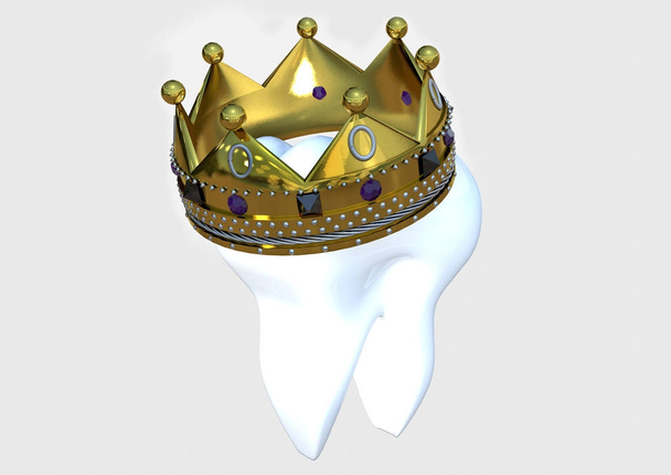 Zub s korunou 3d render - Fotografie, Obrázek