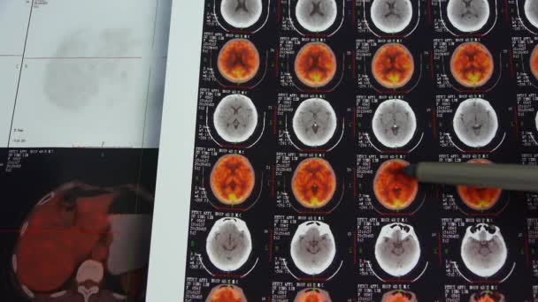 dokter studie kleur hoofd pet / ct, schedel hersenen X-ray. - Video