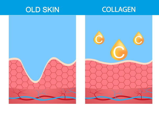 Collagen ,skin vector skin,  structure,  age,  aging,  beauty,  body,  dermatology,  epidermis - Vector, Image