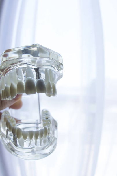 Dental teeth mouth model - Photo, Image
