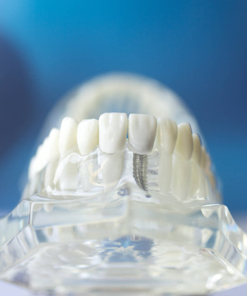 Модель полости рта зуба
 - Фото, изображение