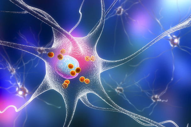 Neuronów w chorobie Parkinsona - Zdjęcie, obraz