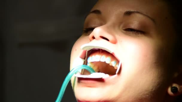 dentista está poniendo frenos en los dientes de una mujer joven
 - Imágenes, Vídeo