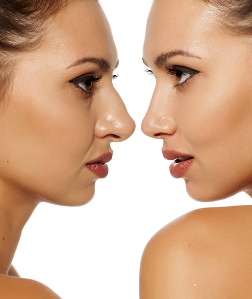 Сравнение женского носа до и после косметической операции
 - Фото, изображение