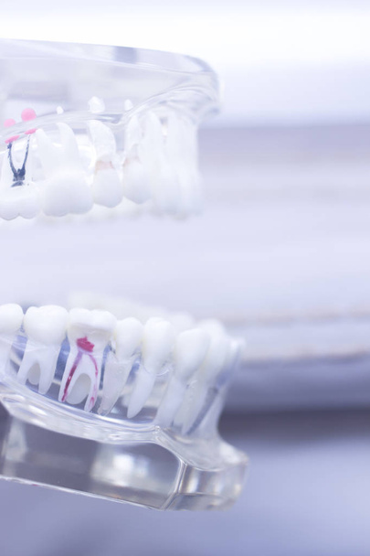 Denti dentali modello bocca
 - Foto, immagini