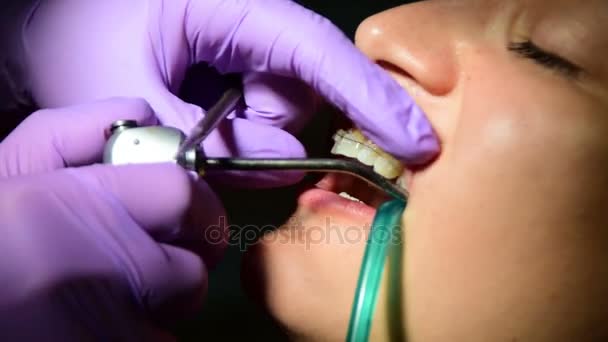 tandarts legt tussen accolades op de tanden van een jonge vrouw - Video