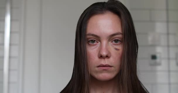 Woman with black eye close-up portrait - Footage, Video
