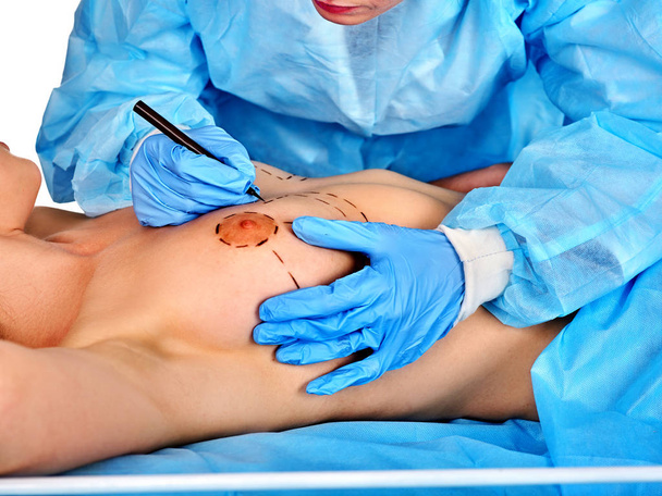 Ο γιατρός κάνει διάστικτη γραμμή στο γυναικείο στήθος . - Φωτογραφία, εικόνα