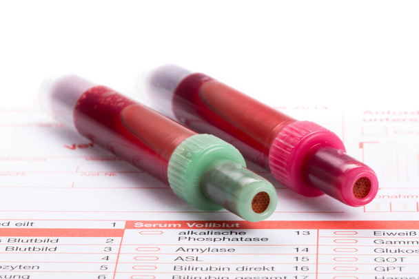 Kan testi, kan örnekleri laboratuvar form üzerindeki - Fotoğraf, Görsel