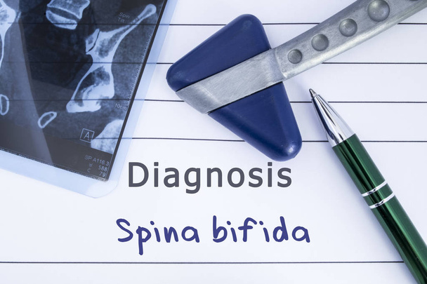 Diagnostic de Spina Bifida. Antécédents médicaux écrits avec diagnostic de Spina Bifida, image IRM colonne vertébrale sacrée et marteau neurologique. Concept médical pour neurologie, neuroscience, neurochirurgie
 - Photo, image