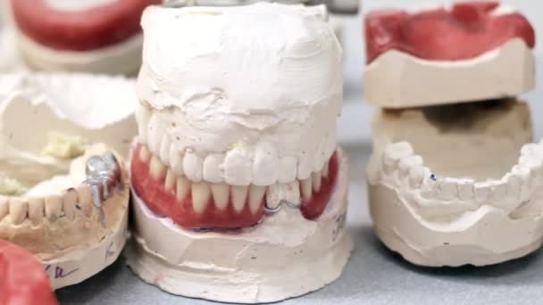 Dental crowns on the models of jaws - Footage, Video