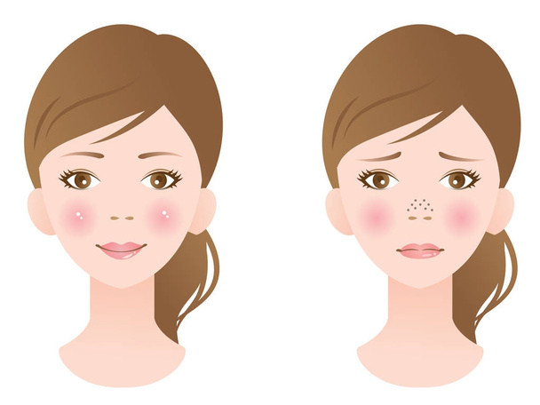 désengorger le traitement des pores sur le visage féminin
 - Vecteur, image