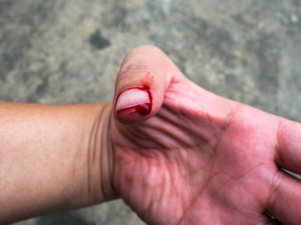 見積もりによって引き起こされる血流の左手の親指を配管の修理に注意しないでください。. - 写真・画像