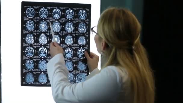 Lékař zkoumá Mri scan pacienta pozorně - Záběry, video