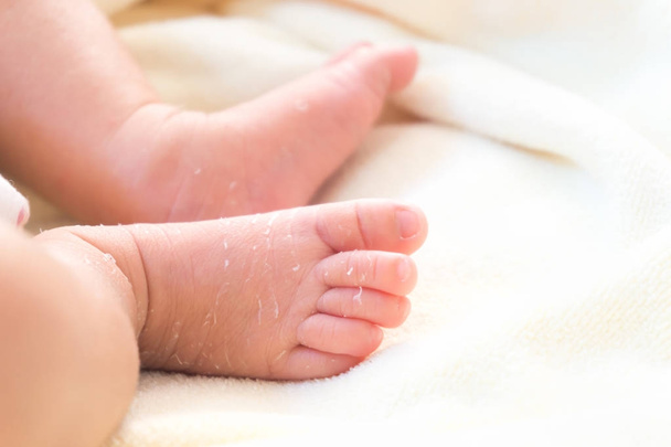 Κινηματογράφηση σε πρώτο πλάνο τα πόδια των νεογέννητων με απολέπιση του δέρματος στο λευκό πανί, υγειονομική περίθαλψη και ιατρική αντίληψη, επιλεκτική εστίαση - Φωτογραφία, εικόνα