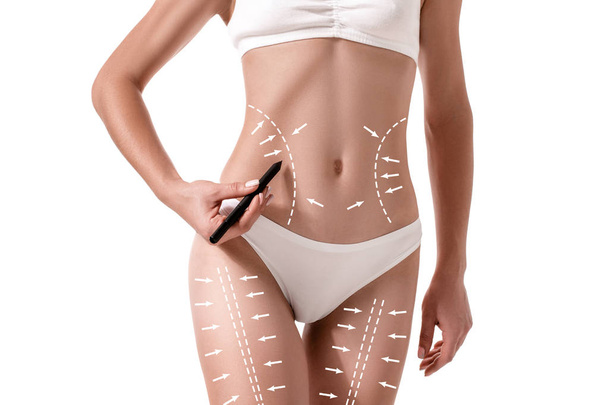 Frauenkörper mit den Zeichnungspfeilen darauf isoliert auf weiß. Fettabbau, Fettabsaugung und Celluliteentfernung. - Foto, Bild