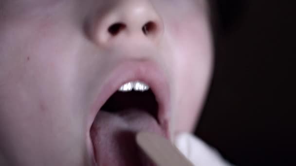 4k Close-up kind gezicht onderzocht door arts in keel - Video
