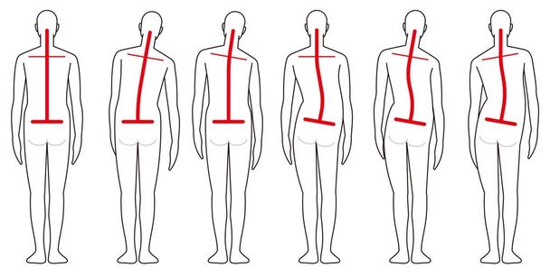 Human back shape  backbone - Vector, Image