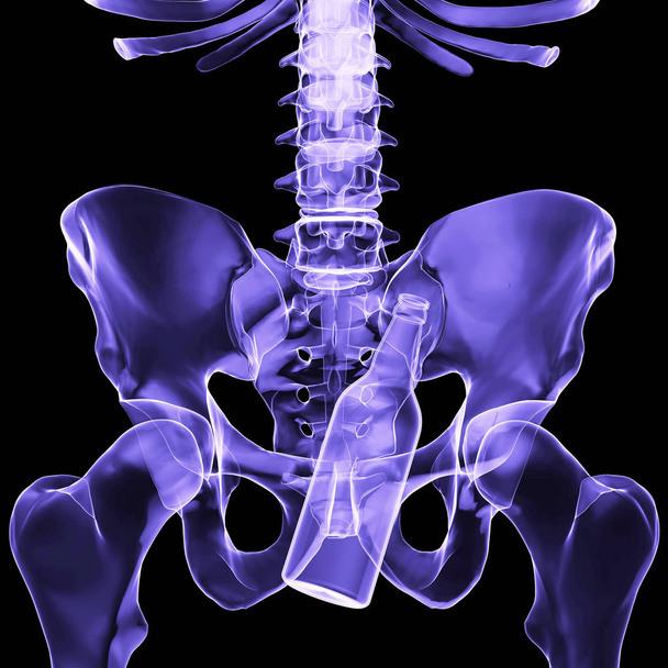X-ışını iskeletin bir şişe 3d render ile - Fotoğraf, Görsel