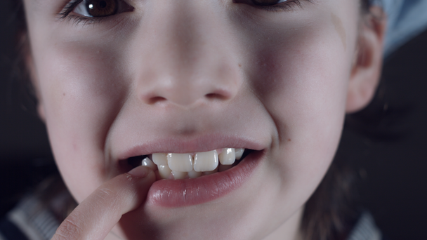 4k close up Kindermund zeigt wackelnden Zahn - Filmmaterial, Video