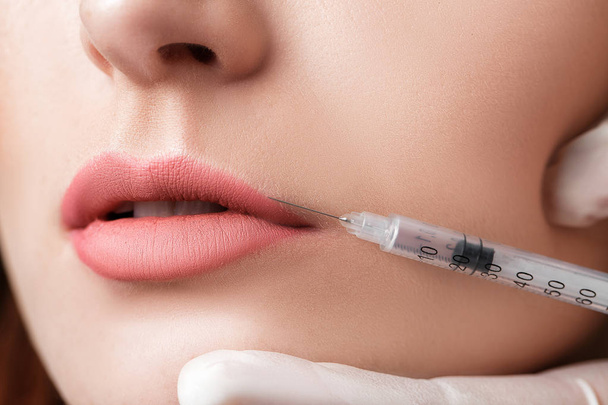 woman getting injection on lips. - Zdjęcie, obraz