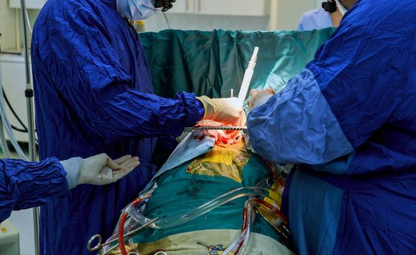 Surgeons perform the operation. Closeup of doctor's hand in gloves during the operation. - Photo, Image