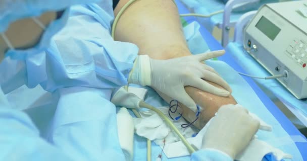 Inovativní metoda operace křečových žil, skleroterapie postup. Close-up shot pacienta nohy - Záběry, video
