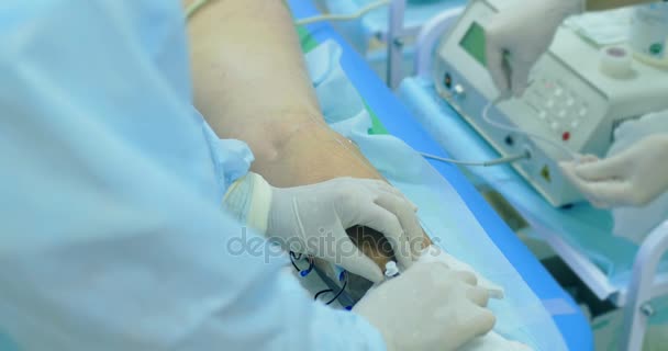 Інноваційний метод хірургії варикозного розширення вен, процедура склеротерапії. Крупним планом знімок ніг пацієнта
 - Кадри, відео