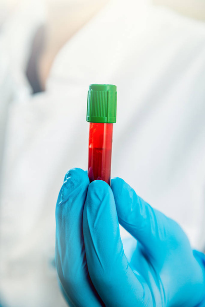 Medical equipment. Blood test - Foto, immagini