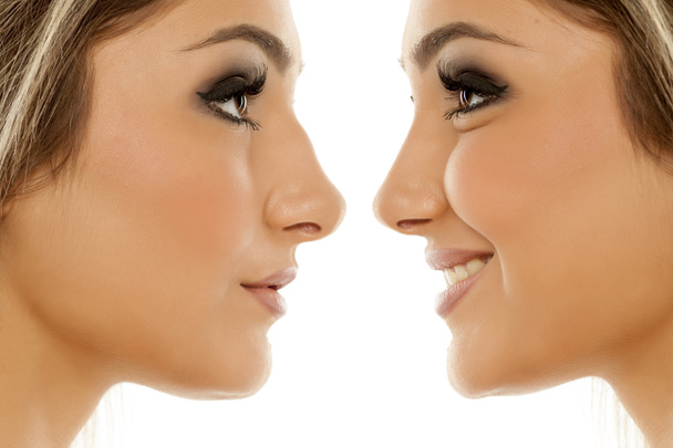 Comparaison d'un nez féminin avant et après une chirurgie plastique
 - Photo, image