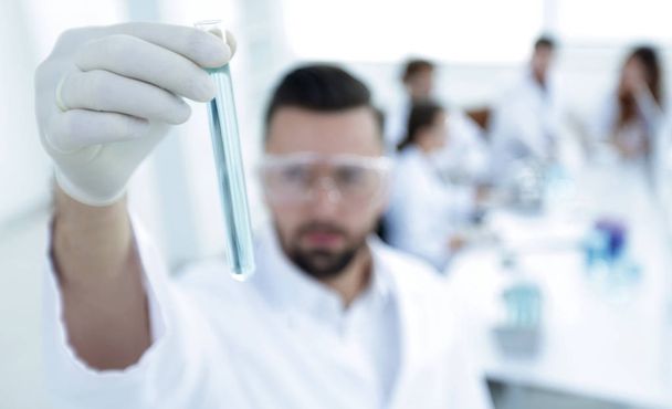 image is blurred. young scientist holding tube with the reagents - Foto, Bild